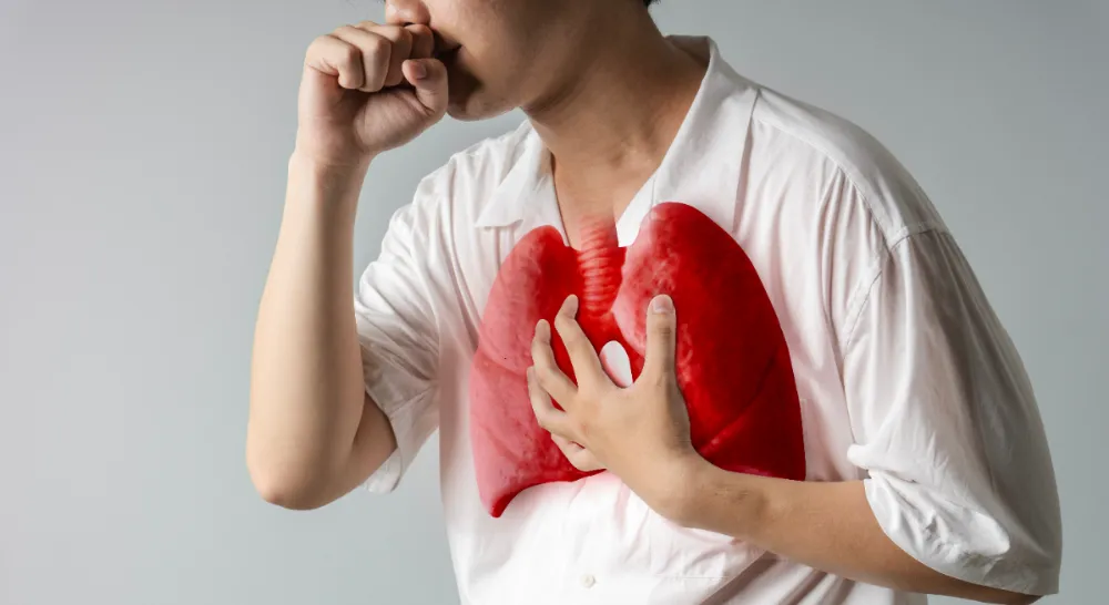 stella-maris-blog-tuberculosis